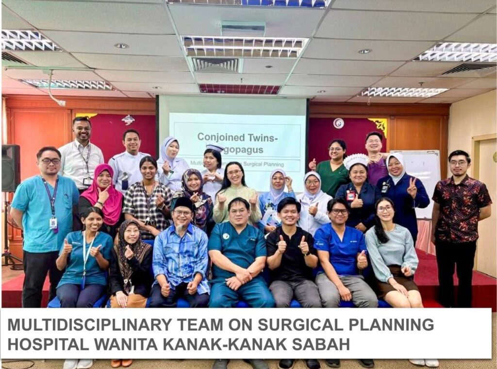 Sabah hospital makes history with successful separation of pygopagus conjoined twins 6 WhatsApp Image 2026 07 07 at 14.55.48 2 1